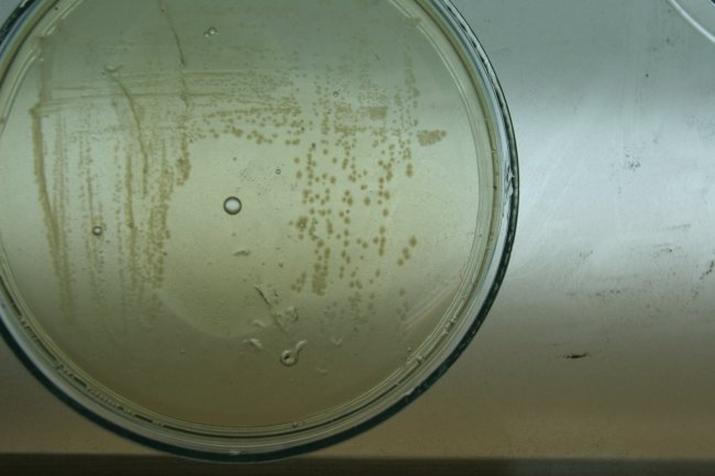 bacteria_petri_dish.jpg